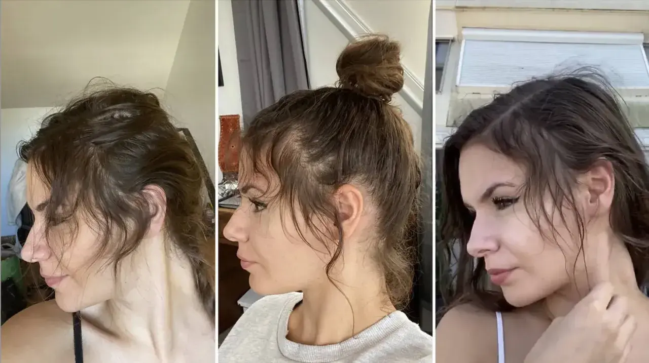Trois profils d'une femme montrant la repousse de ses cheveux, notamment le **cheveux cassé devant** qui s'estompe.