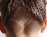 Vue arrière de la tête d'une personne avec des cheveux bruns. Le bas de la nuque est rasé en forme de V, créant un effet de désépaissir cheveux.