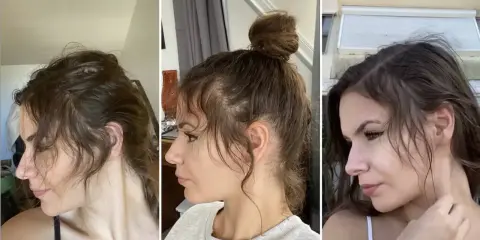 Trois profils d'une femme montrant la repousse de ses cheveux, notamment le **cheveux cassé devant** qui s'estompe.