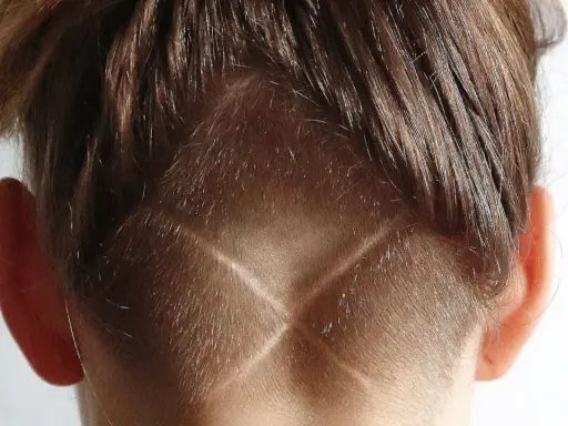 Vue arrière de la tête d'une personne avec des cheveux bruns. Le bas de la nuque est rasé en forme de V, créant un effet de désépaissir cheveux.