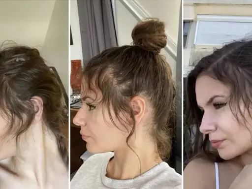 Trois profils d'une femme montrant la repousse de ses cheveux, notamment le **cheveux cassé devant** qui s'estompe.