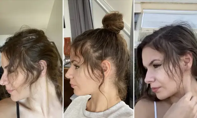 Trois profils d'une femme montrant la repousse de ses cheveux, notamment le **cheveux cassé devant** qui s'estompe.