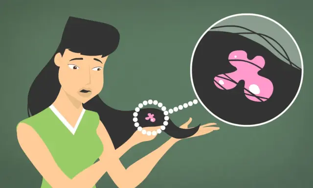 Une jeune femme découvre un chewing-gum rose collé à ses cheveux. Une illustration montre comment enlever un chewing gum dans les cheveux.